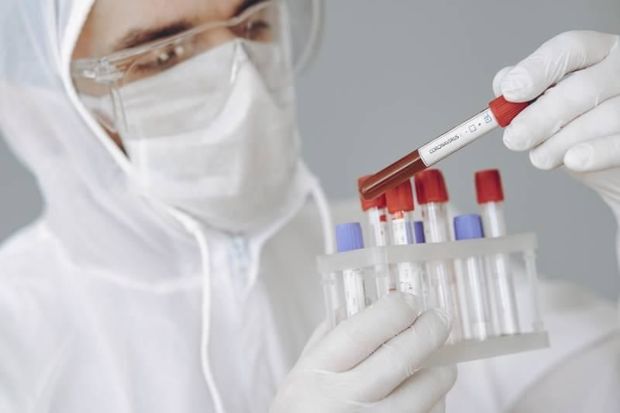 azerbaycanda-koronavirus-ile-bagli-son-veziyyet-aciqlandi